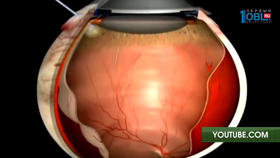 О здоровье 18.03.2017