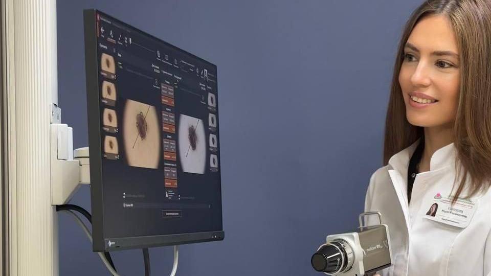 Для выявления рака кожи на Южном Урале используют искусственный интеллект