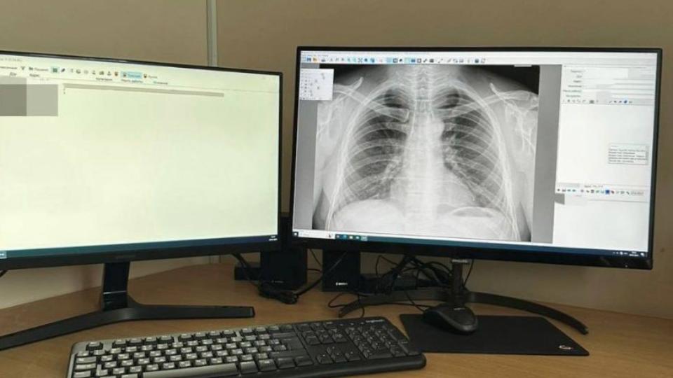 В больнице Коркино работает новый флюорограф