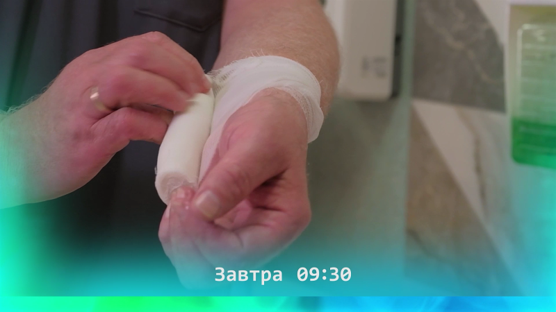 Как оказать первую помощь при ожоге?