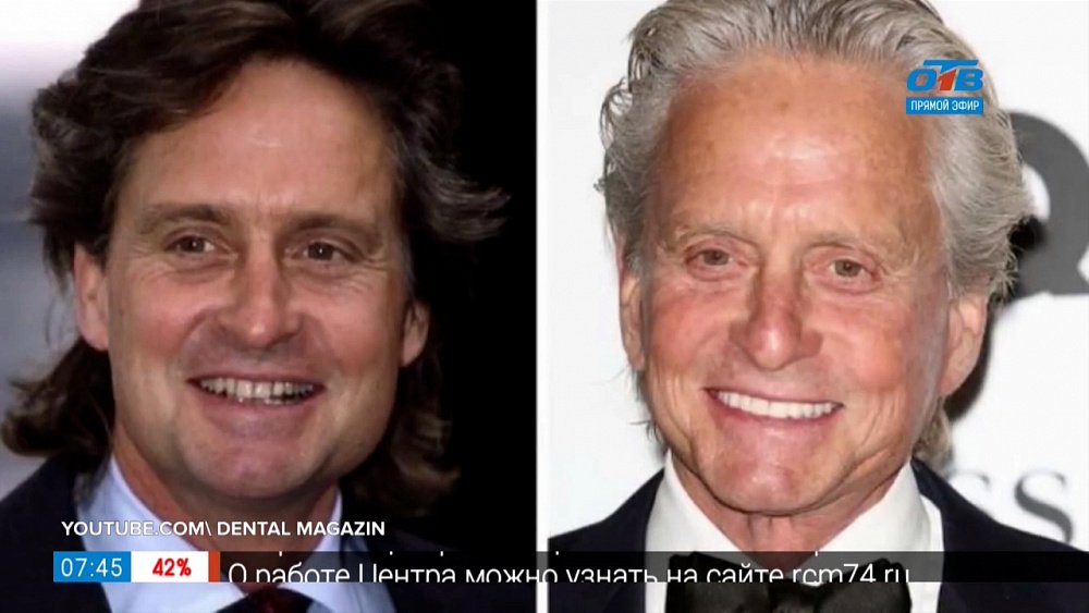 Пройдемся по звездам — голливудские звёзды в винирах