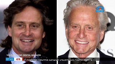 Пройдемся по звездам — голливудские звёзды в винирах