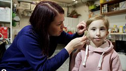 Пластический гример из Челябинска создает эктопротезы для людей без ушей и пальцев