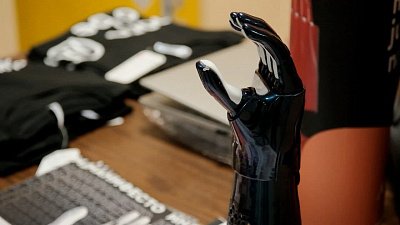 Двум южноуральским малышам подарили киберпротезы рук