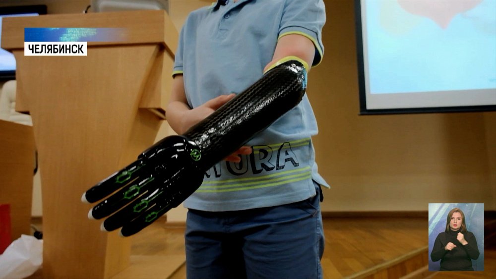 Дети получили умные киберпротезы