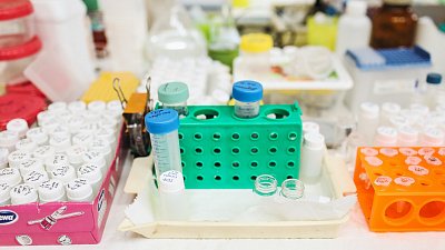 В Челябинске на треть выросло количество пунктов приема меданализов