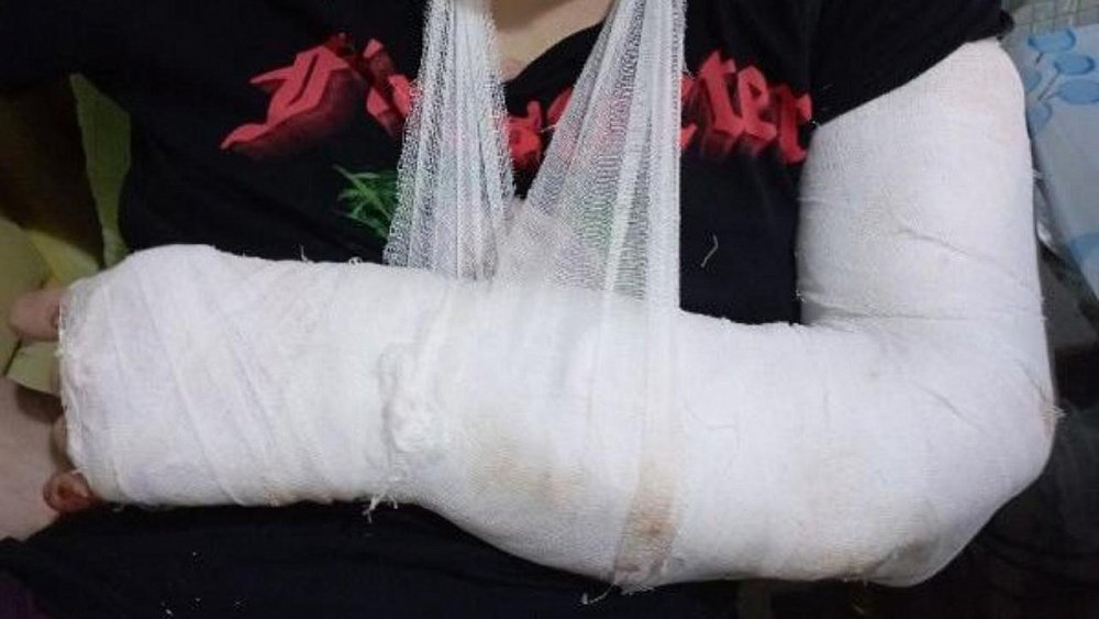 В Челябинске возбудили дело после избиения мужчины курьером «Самоката»