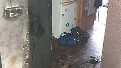 В Копейске 8‑летний мальчик поджег себя, играя со спичками