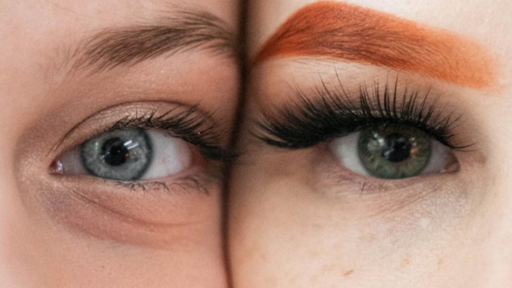 Причины появления мешков под глазами