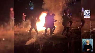 Женщина пострадала во врем фаер-шоу