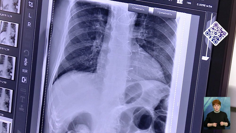 Пациент проглотил золото соседа