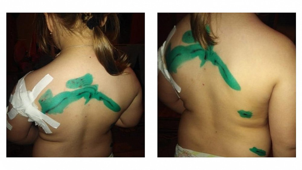 Стая бродячих собак искусала пятилетнюю девочку в Златоусте