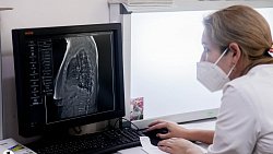 В Челябинской области людей с ВИЧ обеспечат бесплатным углубленным обследованием на туберкулез