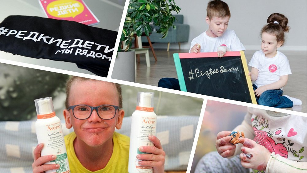 Разбросаны по региону как бисер: как живут редкие и ультраредкие дети из Челябинской области