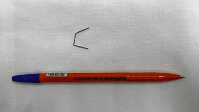 В Челябинске врачи вытащили из горла ребенка острую скрепку