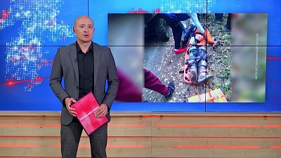 Мотоциклист получил травму на соревнованиях