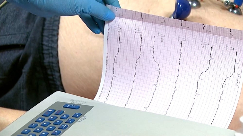 О здоровье 05.11.2022