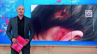 Жена пробила мужу голову за вранье