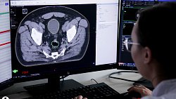 В Челябинске медицинские физики помогают врачам в лечении онкопациентов