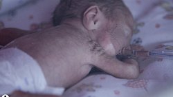 Как в Челябинской области выхаживают детей с экстремально низкой массой тела