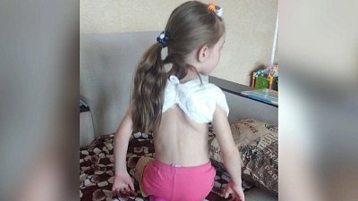 В Челябинске ребенку сломали ключицу в детском саду