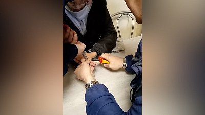 В Челябинске спасатели помогли девушке снять кольцо с пальца