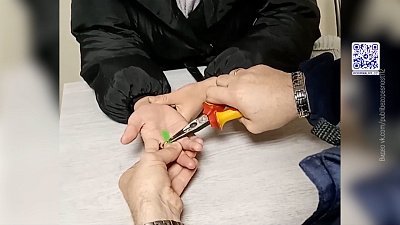 Кольцо едва не оставило девушку без пальца