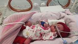 «Была комочком, а теперь человечище!» Челябинские врачи спасли девочку, весившую полкило