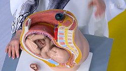 Елена Малышева рассказала о подвиге челябинских врачей в передаче «Жить здорово»