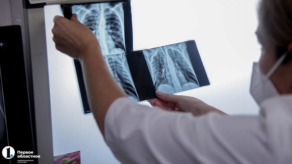 Южноуральцев с ВИЧ бесплатно проверят на туберкулез