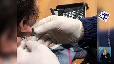Жительница Миасса едва не лишилась уха