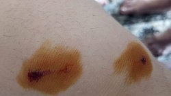 В Челябинской области стая бродячих собак напала на школьника