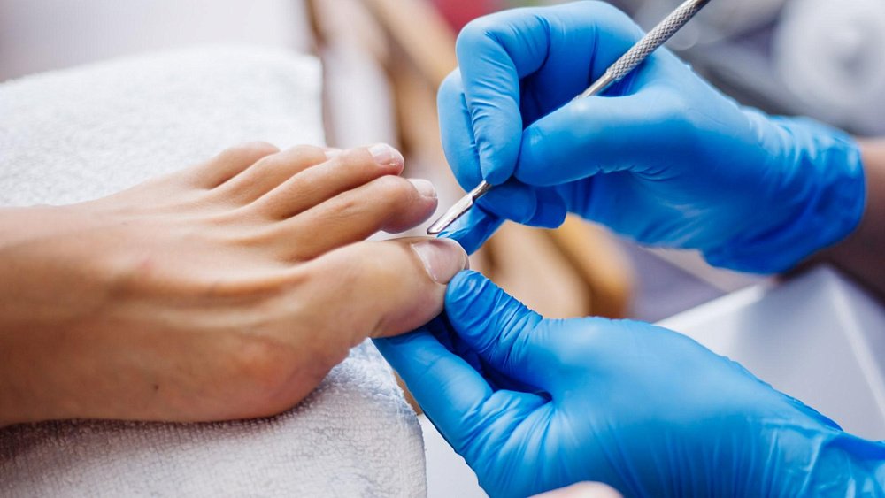 Когда нужно записываться на медицинский педикюр