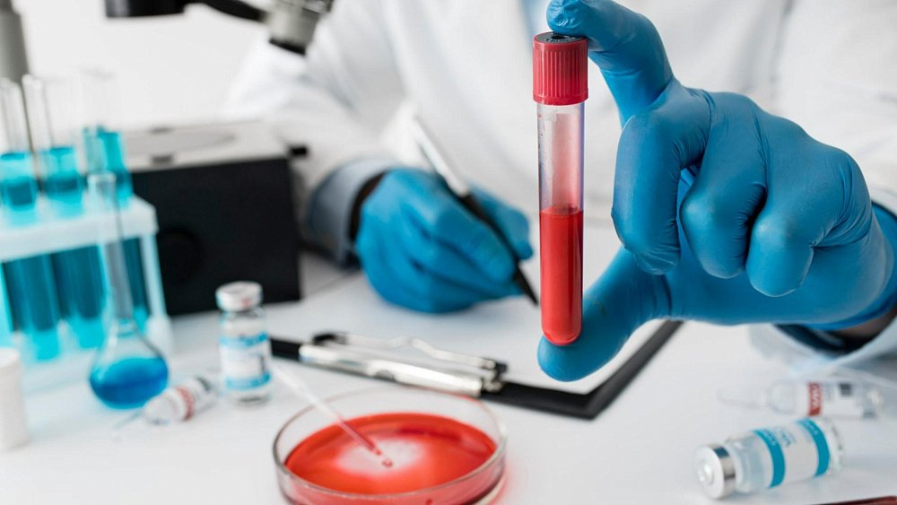 Повышенная мочевая кислота провоцирует проблемы с сердцем