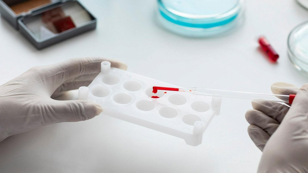 Опасные симптомы жидкой крови