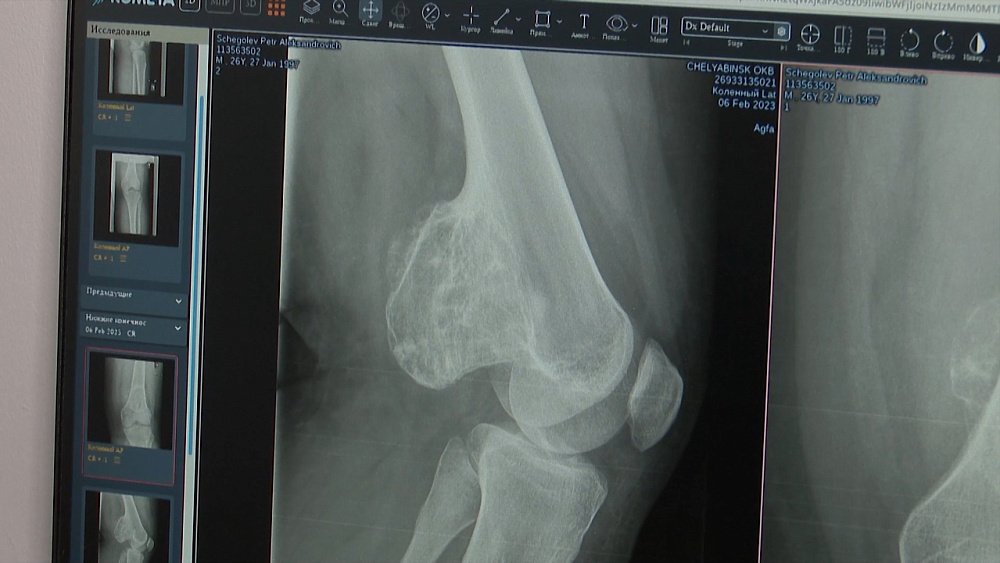 Почему важна мера при употреблении овощей и фруктов? 