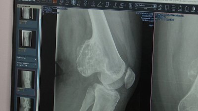 Почему важна мера при употреблении овощей и фруктов? 