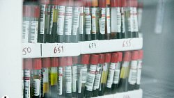 В Челябинске запустили самую крупную в регионе медицинскую лабораторию с пневмопочтой