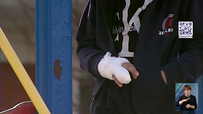 ﻿Шестилетнему мальчику из Челябинска оторвало палец на детской площадке