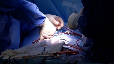 Почему важно посещать стоматолога два раза в год? Узнаете в программе «О здоровье»