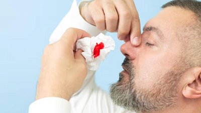Мазь от носовых кровотечений