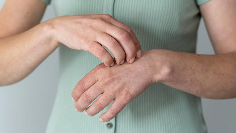 Как избавиться от зуда при комарином укусе