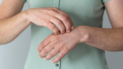 Как избавиться от зуда при комарином укусе