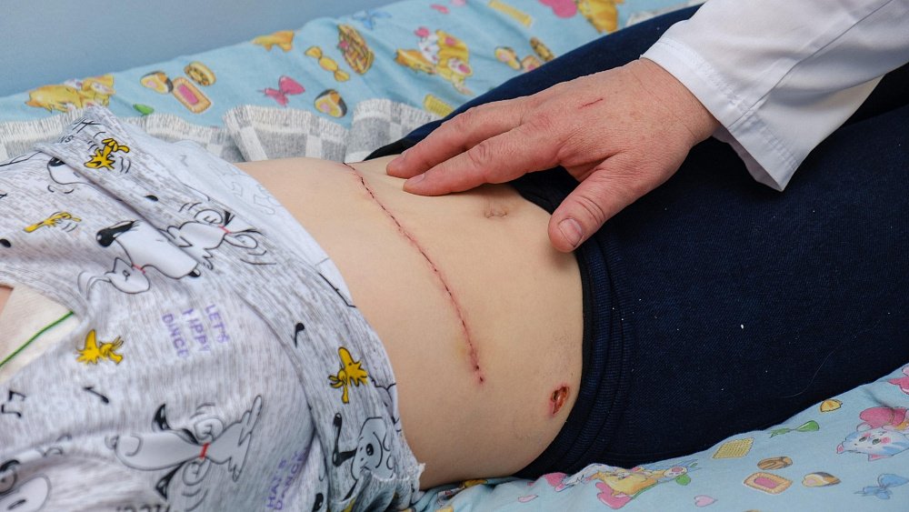 Школьнице из Челябинской области удалили «вторую» печень