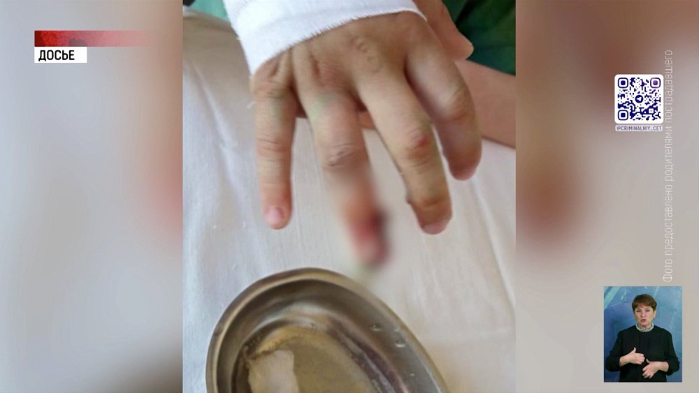 В Челябинске управляющая компания возместит вред школьнику за перелом пальца