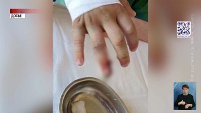 В Челябинске управляющая компания возместит вред школьнику за перелом пальца