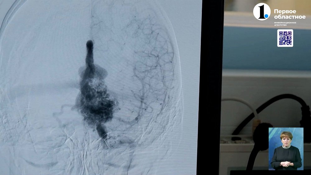 За год в ЧОКБ удаляют 100 аневризм