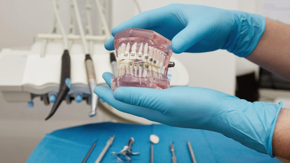 Долго ли нужно носить ретейнеры