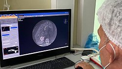 В Челябинском онкоцентре научились прижигать рак