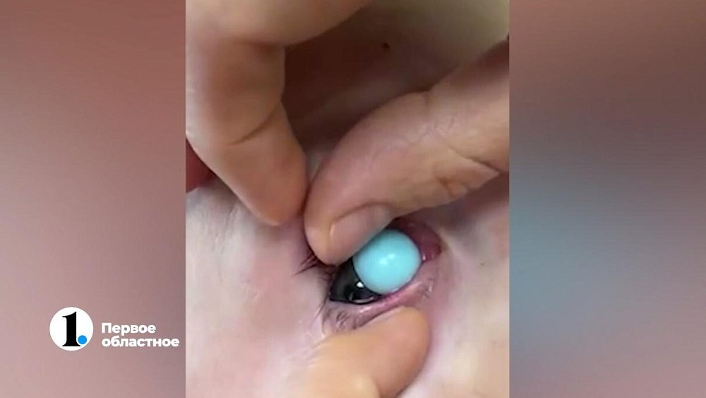 Деталь от поп‑ит застряла в глазу семилетнего мальчика из Челябинска